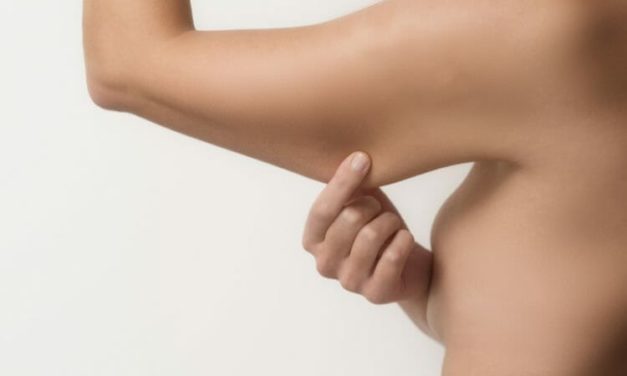 How to Get Rid of Underarm Flab