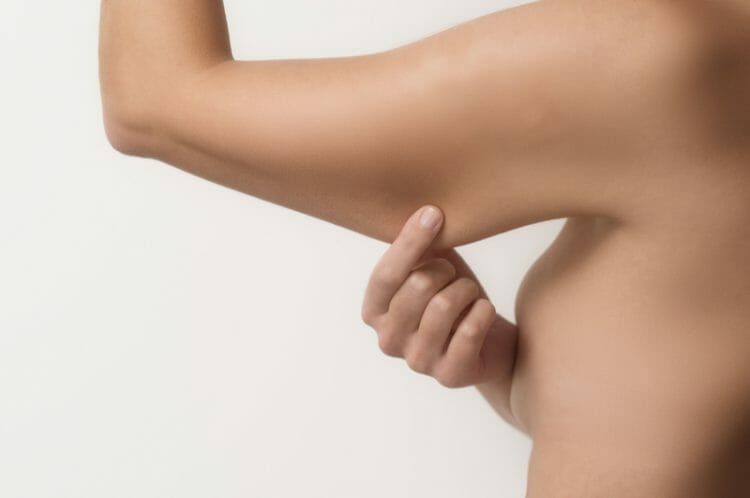 How to Get Rid of Underarm Flab